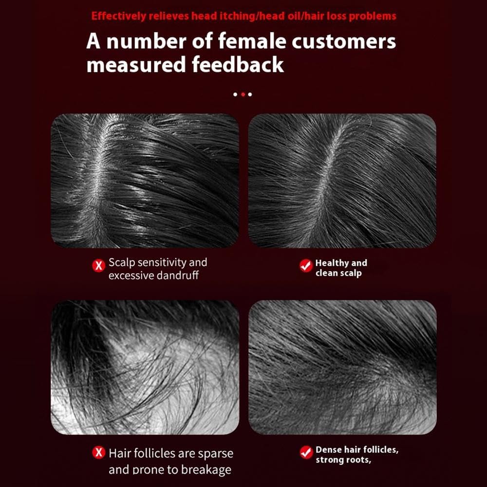 Electric Hair Growth Scalp Massager with LED Therapy