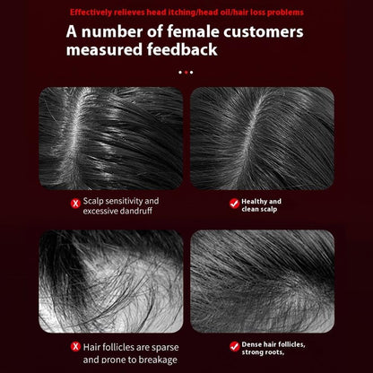 Electric Hair Growth Scalp Massager with LED Therapy